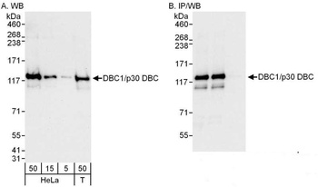 Rabbit anti-DBC1/p30 DBC Antibody, Affinity Purified