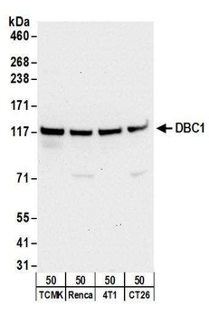 Rabbit anti-DBC1/p30 DBC Antibody, Affinity Purified