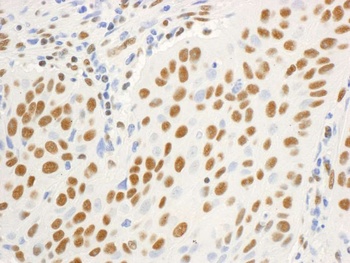 Rabbit anti-DBC1/p30 DBC Antibody, Affinity Purified