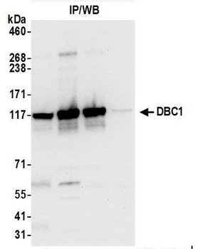Rabbit anti-DBC1/p30 DBC Antibody, Affinity Purified