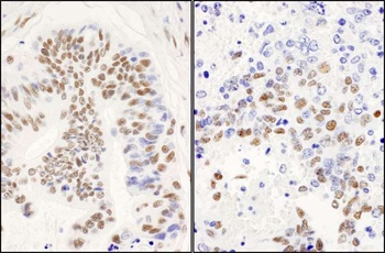Rabbit anti-DBC1/p30 DBC Antibody, Affinity Purified