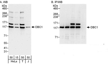 Rabbit anti-DBC1/p30 DBC Antibody, Affinity Purified