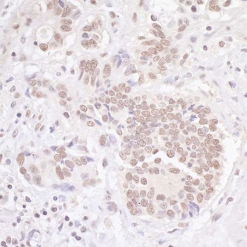 Rabbit anti-TBLR1 Antibody, Affinity Purified