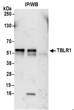 Rabbit anti-TBLR1 Antibody, Affinity Purified