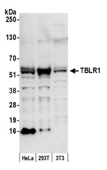 Rabbit anti-TBLR1 Antibody, Affinity Purified