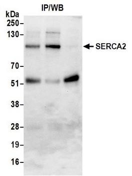 Rabbit anti-SERCA2 Antibody, Affinity Purified