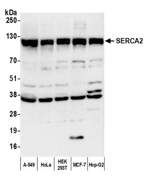 Rabbit anti-SERCA2 Antibody, Affinity Purified