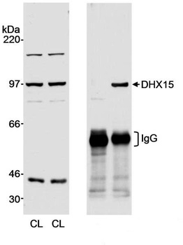 Rabbit anti-DHX15 Antibody, Affinity Purified