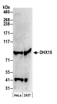 Rabbit anti-DHX15 Antibody, Affinity Purified