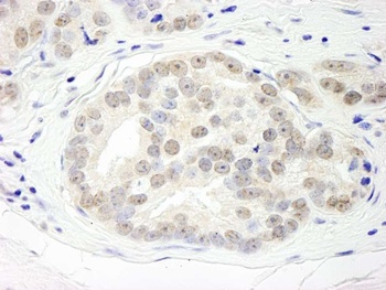 Rabbit anti-DHX15 Antibody, Affinity Purified