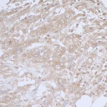 Rabbit anti-BIRC6/Apollon Antibody, Affinity Purified