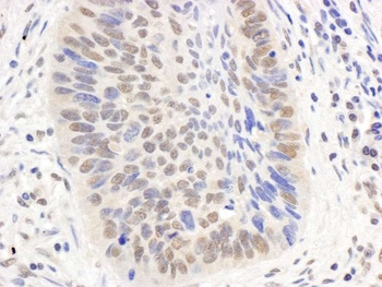 Rabbit anti-p300 Antibody, Affinity Purified