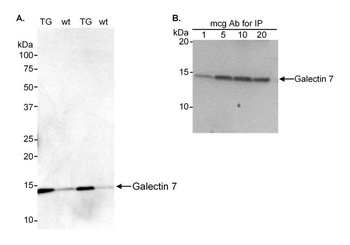 Rabbit anti-Galectin-7 Antibody, Affinity Purified