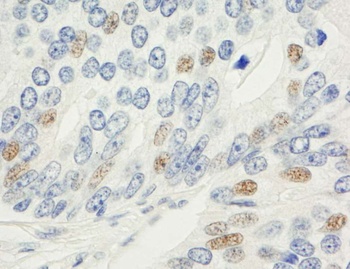 Rabbit anti-MAD1 Antibody, Affinity Purified