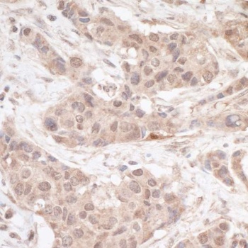 Rabbit anti-FHL2 Antibody, Affinity Purified