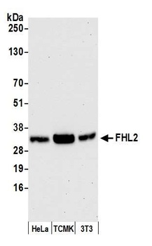 Rabbit anti-FHL2 Antibody, Affinity Purified