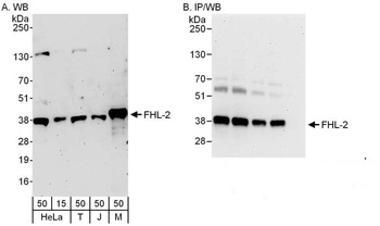 Rabbit anti-FHL2 Antibody, Affinity Purified