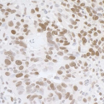 Rabbit anti-FUS Antibody, Affinity Purified