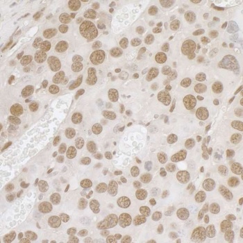 Rabbit anti-FUS Antibody, Affinity Purified