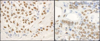 Rabbit anti-FUS Antibody, Affinity Purified