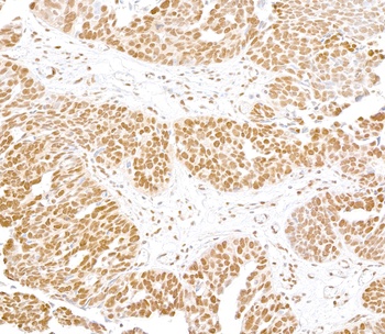 Rabbit anti-FUS Antibody, Affinity Purified