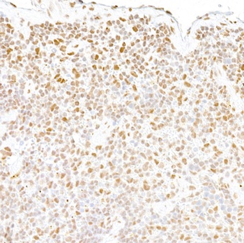 Rabbit anti-FUS Antibody, Affinity Purified