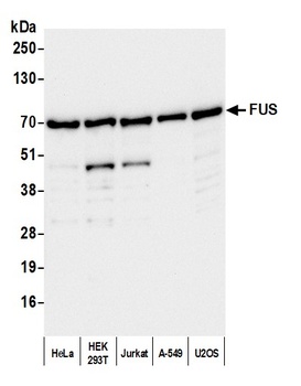 Rabbit anti-FUS Antibody, Affinity Purified