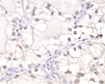 Rabbit anti-HIF1-alpha Antibody, Affinity Purified
