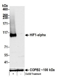 Rabbit anti-HIF1-alpha Antibody, Affinity Purified