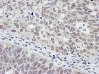 Rabbit anti-MTA1 Antibody, Affinity Purified