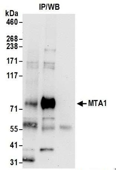 Rabbit anti-MTA1 Antibody, Affinity Purified