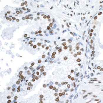 Rabbit anti-53BP1 Antibody, Affinity Purified