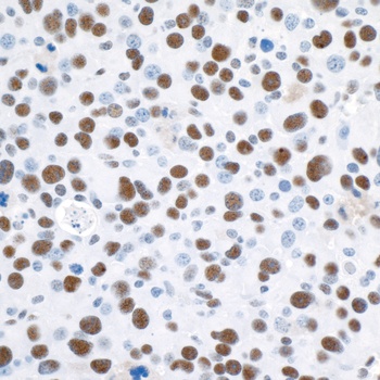 Rabbit anti-53BP1 Antibody, Affinity Purified