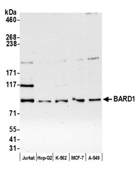 Rabbit anti-BARD1 Antibody, Affinity Purified