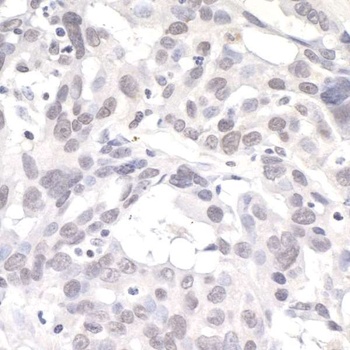 Rabbit anti-PNK1 Antibody, Affinity Purified