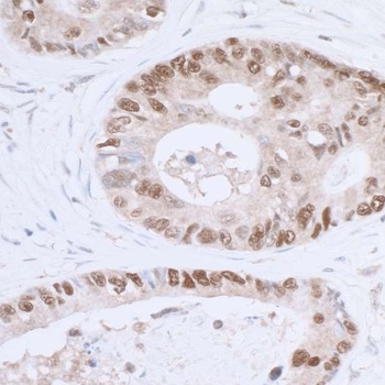 Rabbit anti-p53 Antibody, Affinity Purified