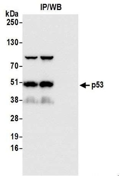 Rabbit anti-p53 Antibody, Affinity Purified