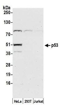 Rabbit anti-p53 Antibody, Affinity Purified