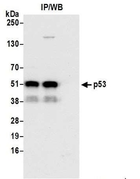 Rabbit anti-p53 Antibody, Affinity Purified