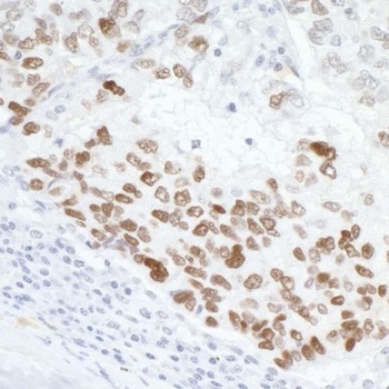 Rabbit anti-p53 Antibody, Affinity Purified