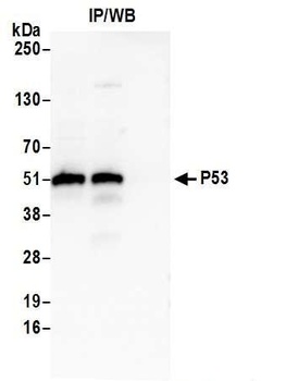Rabbit anti-p53 Antibody, Affinity Purified
