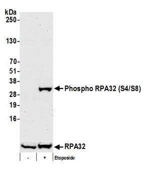 Rabbit anti-Phospho RPA32 (S4/S8) Antibody, Affinity Purified