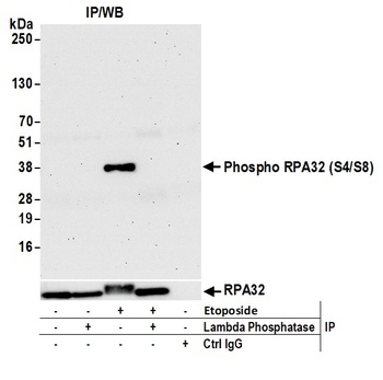Rabbit anti-Phospho RPA32 (S4/S8) Antibody, Affinity Purified