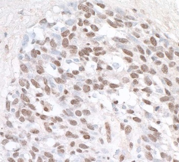 Rabbit anti-ZHX1 Antibody, Affinity Purified