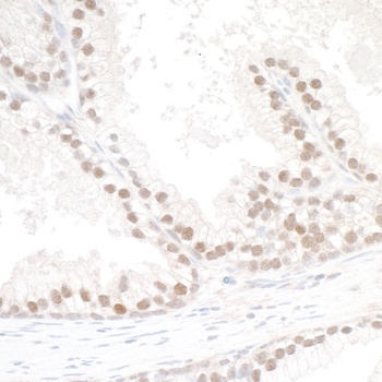 Rabbit anti-SMC6 Antibody, Affinity Purified