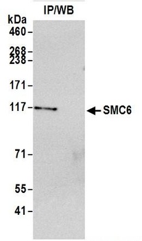 Rabbit anti-SMC6 Antibody, Affinity Purified