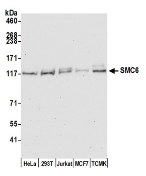 Rabbit anti-SMC6 Antibody, Affinity Purified