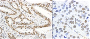 Rabbit anti-Phospho XRCC1 (S485/T488) Antibody, Affinity Purified