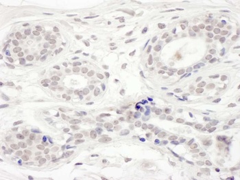 Rabbit anti-BRD8 Antibody, Affinity Purified