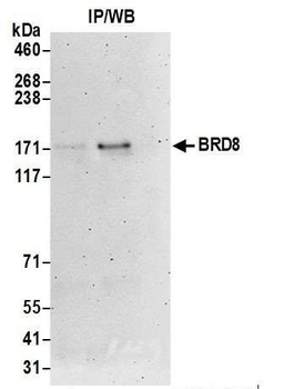 Rabbit anti-BRD8 Antibody, Affinity Purified
